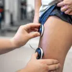 Electrostimulation to Lose Weight