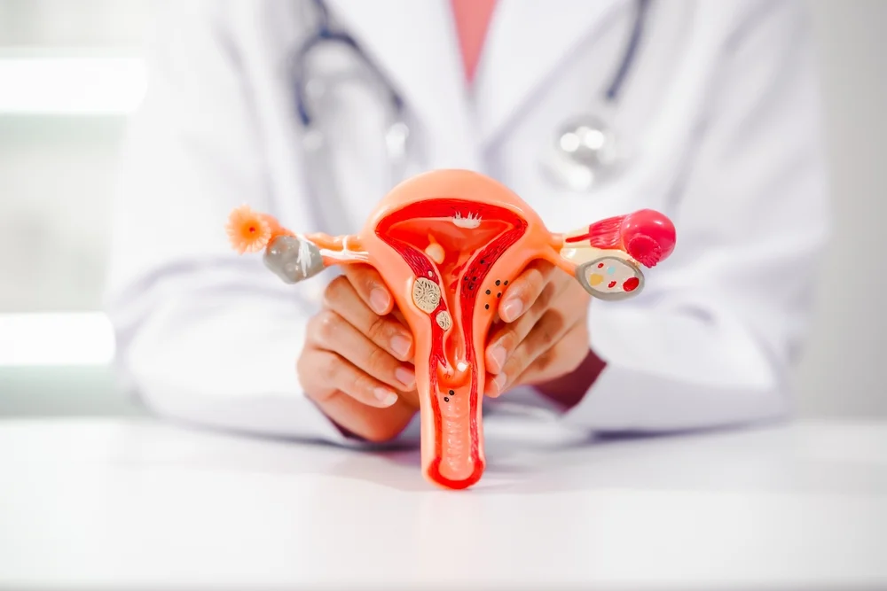 endometriosis